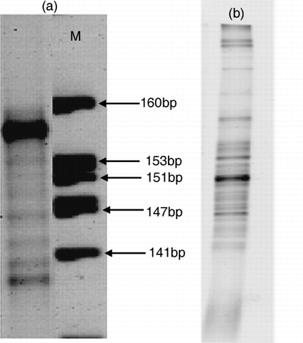 Figure 5  (a) Size separation and (b) denaturing gradient gel electrophoresis (DGGE) patterns of soil bacterial 16S rDNA amplified with primer set III. Lane M in (a) is the size marker.