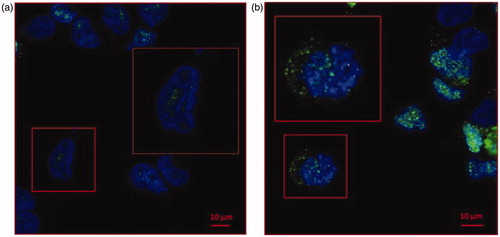 Figure 1. Confocal microscopy analysis of CA IX expression in LNCaP cell line cultured at pH 7.4 and pH 6.5. (a)LNCaP cells cultured at pH 7.4 showed low expression of CA IX (green signal) predominately nuclear (blue signal of DAPI). (b) CA IX expression in LNCaP pH 6.5 is higher compared to pH 7.4 and showed a strong cytoplasmic expression.