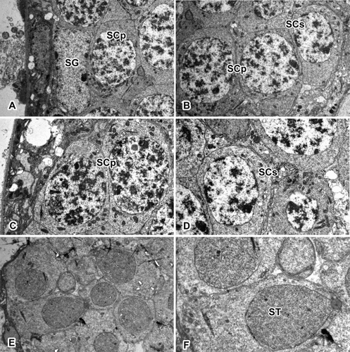 Figure 2. Transverse section of the testis in L. cornutus. Spermatogenesis in spider testis occurs along inward direction. Spermatogonium stays along the testicular membrane, maintaining the cell line. As development progresses, spermatocytes moves inward to produce differentiated cells. SG: spermatogonium; SCp: primary spermatocyte; SCs: secondary spermatocyte; ST: spermatid. Magnifications are as follow: (a, b, e) ×2800; (c, d) ×3900; (f): ×5800.