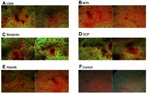 Figure 5 Alizarin red staining: calcified nodules produced by the stem cells of the apical papilla (SCAPs) following treatment with biomaterials (A) CEM cement, (B) MTA, (C) Biodentine, (D) OCP, (E) Atlantik, (F) control.