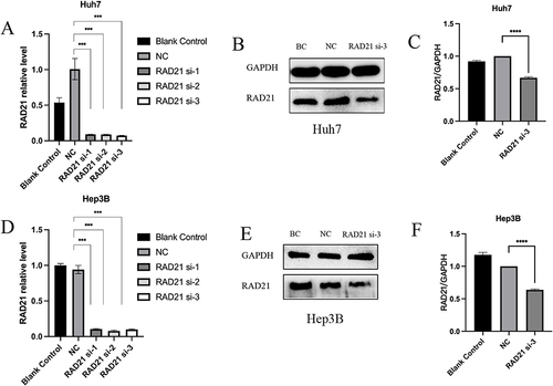 Figure 6 RAD21 mRNA and protein levels after liver cancer cells transfected with siRNA. RAD21 mRNA levels in Huh7 (A) and Hep3B (D) cells after siRNA transfection; RAD21 protein levels in Huh7 (B and C) and Hep3B (E and F) cells after siRNA transfection. Note: *** indicates p< 0.001, and **** indicates p< 0.0001.