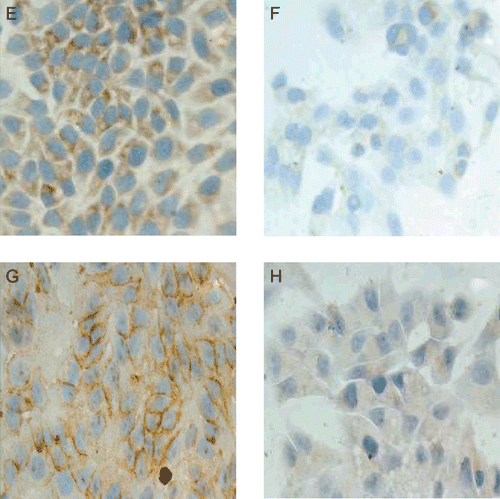 Figure 3.  Matrine down-regulated the expression of AFP and PCNA proteins. HepG2 cells incubated with absence (E, G) or presence of 0.8 mg/mL matrine for 2 days were determined with immunohistochemistry analysis. HepG2 cells were viewed under multifunctional microscope (×400magnification). Immunostaining intensity of AFP (F) and PCNA (H) were weaker than control. The decrease demonstrated the down-regulation of protein expression.