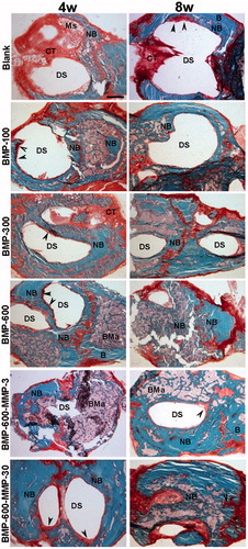 Figure 2. Representative images of the defect in the different experimental groups at 4 and 8 weeks post-implantation. Photomicrographs of horizontal sections of the calvarial defects implanted with systems loaded with 100, 300 and 600 ng of BMP-2 in microsphere and the systems containing a combination of BMP-2 and MMP-10 in microspheres: 600 ng of BMP-2:3 ng of MMP10 (ratio 200:1) and 600 ng of BMP-2: 30 ng of MMP10 (ratio 20:1). Arrowheads in the different images indicate active areas of osteosynthesis in the defect margins. B: host bone; BMa: bone marrow; CT: connective tissue; DS defect site; NB: newly formed bone; Ms: microspheres. Scale bar 1 mm.