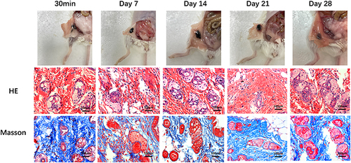 Figure 6 Photographs, HE staining, and Masson staining of M@SHDS in mice subcutaneously at different time points (30 min, Day 7, 14, 21, 28).