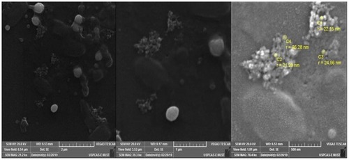 Figure 5 Scanning electron microscopic images of selenium nanoparticles derived from Foeniculum vulgare Mill. seed extract at 2 µm, 1 µm and 500 nm depicting spherical to irregular morphology of selenium nanoparticles.