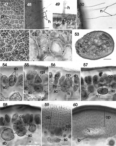 Figs 47–60. Gracilaria multipartita. Vegetative development and female prefertilization and early post-fertilization stages. Fig. 47. Surface view showing parietal plastids in multinucleate cells, and some cells with reticulate plastid (arrow) (HGI–A 2300). Fig. 48. Surface view of thallus with long deciduous hairs (HGI–A 16029). Fig. 49. Multinucleate hair primordium pit connected (arrow) to a deciduous hair (HGI–A 16029). Fig. 50. Deciduous hairs, each with a median nucleus (HGI–A 16029). Fig. 51. Surface view showing multinucleate hair primordia (arrows) (HGI–A 2300). Fig. 52. Medulla in transverse section showing secondary pit connections (arrows) (HGI–A 16029). Fig. 53. Transverse section of stipe (HGI–A 16029). Fig. 54. Supporting cell pit connected (arrow) to two side branches (HGI–A 16029). Fig. 55. Uninucleate supporting cell bearing a carpogonial branch initial and one side branch (HGI–A 16029). Fig. 56. Supporting cell initiating a two-celled carpogonial branch consisting of a terminal carpogonium and subterminal hypogynous cell surrounded by side branches (HGI–A 16029). Fig. 57. Binucleate carpogonium (HGI–A 16029). Fig. 58. Early post-fertilization stage showing broadening of the pit connection (arrow) between the hypogynous cell and the supporting cell (HGI–A 16029). Fig. 59. Post-fertilization stage showing an enlarged carpogonial fusion cell that has grown by incorporating cells from the associated outer pericarp (HGI–A 16029). Fig. 60. Initiation of cavity (arrow) between outer and inner pericarps (HGI–A 16029). Scale bars: Figs 47, 48, 50–52, 54–60 = 20 µm; Fig. 49 = 50 µm; Fig. 53 = 500 µm. Haematoxylin. Abbreviations: cbc = carpogonial branch cell; cp = carpogonium; cpi = carpogonial branch initial; gfi = gonimoblast filament initial; h = hair; hp = hair primordium; hy = hypogynous cell; ip = inner pericarp; n = nucleus; op = outern pericarp; pl = plastid; sb = side branch; sc = supporting cell.