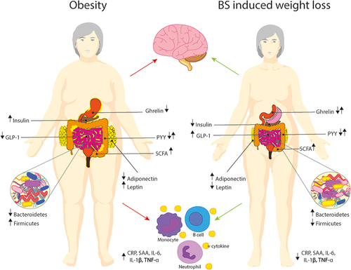Figure 1 Changes in body composition and hormones after bariatric surgery. Insulin, leptin and various short-chain fatty acids are increased, while ghrelin and adiponectin are decreased in individuals with obesity compared to lean controls. Levels of PYY have been shown to be higher, lower or unaltered in obesity. After bariatric surgery all these endocrine and insulin levels improved in comparison to pre-surgery patients. Obesity also has negative effects on inflammation. Multiple immune cells are involved in obesity driven inflammation, such as macrophages, T-cells, cytotoxic cells, among others. Increased cytokines and low grade systemic inflammation are a hallmark of obesity and may cause alterations in cognition and brain structure. Bariatric surgery seems to improve both these factors on a global level.