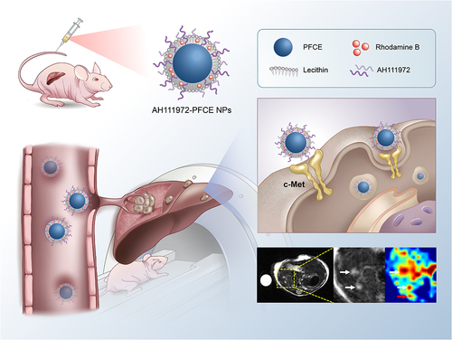 Scheme 1 Schematic illustration of targeted binding of AH111972-PFCE NPs to c-Met for precise detection of missing and ill-defined colorectal liver metastases.