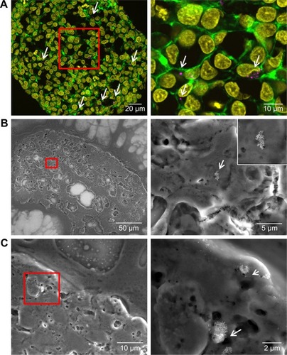 Figure 7 Distribution of SiO2 NPs in HepG2 spheroids added at the beginning of spheroid formation.Notes: 100 µg mL−1 SiO2 NPs were applied at seeding day 0 for 7 days. For imaging, spheroids were fixed and cut into 10-µm-thick cryoslices. Representative images of the samples are shown. (A) CLS images of the spheroids. After preparation of cryoslices, samples were stained for CLS microscopy. The cell nucleus (yellow), cytoskeleton (green), and SiO2 NPs (magenta) are imaged. Red box indicates the detailed image position, which is derived from a maximum projection, shown on the right. (B, C) Backscattered electron micrographs of a spheroid overview (left) and a detailed image (right) are shown. Red box indicates the detailed image position. Arrows highlight the localization of SiO2 NPs in the spheroid.Abbreviations: CLS, confocal laser scanning microscopy; NPs, nanoparticles.
