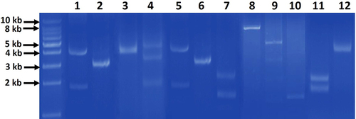 Figure 1 Representative agarose gel (0.7%) electrophoresis of the different patterns of extracted plasmids from gut commensal E. coli isolates. The patterns comprised of one band (lanes 2, 3, 6, 8, 10, 12), two bands (lanes 1, 5, 7, 9, 11) and three bands (lane 4) of different sizes. First most left lane, 1 kb DNA molecular weight marker.