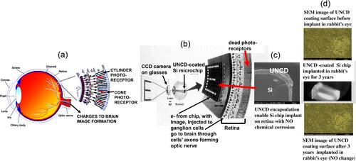 Figure 18. (a) Schematic showing key eye’s components (lens, retina and optical nerve) responsible for vision; (b) Si microchip coated with UNCD receives images from a CCD camera and process the images into electronic charges that are injected on the ganglion cells, via electrically conductive/eye’s humor corrosion resistant N-UNCD coated large array of Si or metallic tips, and transferred through cells axons (optic nerve), to the brain to form images; (c) cross-section SEM image of insulating/high density/pinhole free/corrosion resistant UNCD coating encapsulating Si chip; (d) (top) SEAM image of UNCD coating surface before implantation of UNCD-encapsulated Si chip in rabbit eye, (middle) UNCD-encapsulated Si chip implanted in rabbit’s eye for 3 years (bottom), SEM image of UNCD coating surface after 3 years implantation, with no degradation at all.