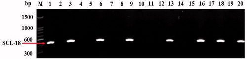 Figure 3. Verification of SCAR marker SCL-18. Lanes 1–20 indicate verified strains (B1–B20) of nationally accredited varieties in China (Table 1). Single 522-bp band was amplified by SCL-18 primer in lane 1, 3, 6, 9, 13, 16, 18, and 20, corresponding to strains with cluster-type fruiting body pattern (Table 1). M: 1500-bp ladder marker.