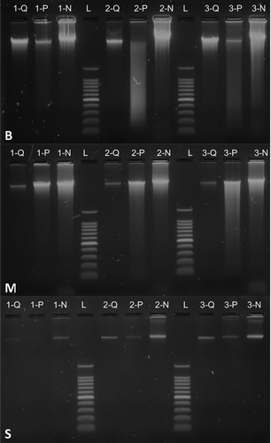 Figure 1. Gel electrophoresis of DNA isolated from three animal tissue types by three different protocols. Top down, the panels show DNA extractions from avian blood (B), shark muscle (M) and amphibian skin swabs (S). Numbers correspond to different individuals of eared dove (Zenaida auriculata) (panel B), silky shark (Carcharhinus falciformis) (panel M), and cane toad (Rhinella marina) (panel S). Letters correspond to the three methods employed: DNeasy Blood and Tissue Kit by QIAGEN (Q), Wizard Genomic DNA Purification Kit by Promega (P) and our protocol (N). The molecular-weight size marker (L) used was the 100 bp DNA Ladder by Promega, the heaviest fragment of which is 1500 bp.