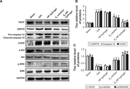 Figure 10 E2-HP hydrogel inhibits ER stress and activates the Akt and ERK1/2 pathways in the IUA rats.Notes: (A) The protein expressions of VEGF, GRP78, caspase-12, CHOP, p-Akt, and p-ERK in each group were tested with Western blotting. GAPDH was used as the loading control and for band density normalization. (B) The optical density analysis of GRP78, caspase-12, and CHOP protein. **P<0.01 versus the Sham group and #P<0.05 and ##P<0.01 versus the IUA group. (C) The optical density analysis of VEGF, p-Akt, and p-ERK protein. **P<0.01 versus the Sham group and #P<0.05 and ##P<0.01 versus the IUA group. Data are presented as mean ± standard deviation; n=3.Abbreviations: CHOP, C/EBP homologous protein; ER, endoplasmic reticulum; GRP78, glucose-regulated protein; IUA, Intrauterine adhesions; HP, heparin-poloxamer.