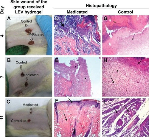 Figure 10 Skin wound and histopathology of the group received LEV hydrogel.