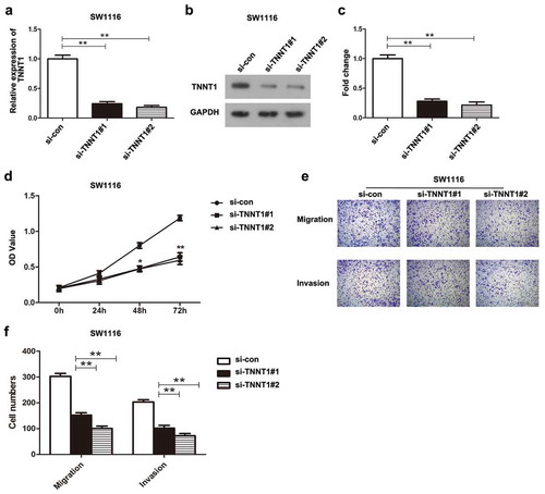 Figure 2. Knockdown of TNNT1 inhibited proliferation, migration and invasion of SW1116 cells.(a) The expression of TNNT1 was dramatically decreased after si-TNNT1#1/si-TNNT1#2 transfection using qRT-PCR analysis. (b) The protein expression of TNNT1 was impaired by si-TNNT1#1/si-TNNT1#2 compared with si-con group and (c) quantified. (d) The proliferative ability was examined by CCK-8 assay. (e) and (f) Cell migration and invasion were exhibited and the cell numbers were quantified. *P < 0.05 and **P < 0.01.