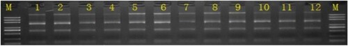 Figure 1. Electrophoresis of total RNA detection (M, Marker; 1∼3, Control group; 4∼6, EAE group; 7∼9, EAS group; 10∼12, rh-EGF Group).