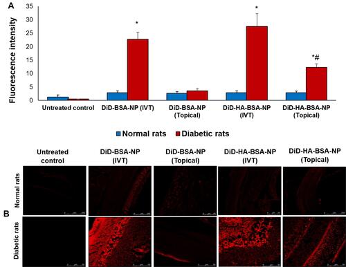 Figure 5 Retinal biodistribution by confocal laser microscopy five hours post single intravitreal and topical application of DiD-BSA-NP and DiD-HA-BSA-NP showing: (A) fluorescence intensity in normal and diabetic rats, (B) fluorescence images, upper panel for normal rats and lower panel for diabetic rats administered (a, b) untreated control, (c, d) intravitreal DiD-BSA-NP, (e, f) topical DiD-BSA-NP, (g, h) intravitreal DiD-HA-BSA-NP and (i, j) topical DiD-HA-BSA-NP. *p<0.05 for diabetic rats vs similarly treated normal rats, #p<0.05 for HA-coated NP vs the uncoated NPs administered by the same route.