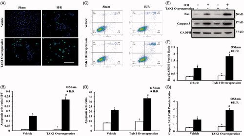 Figure 5. Upregulation of TAK1 aggravates apoptosis of renal tubular epithelial cells with H/R treatment. (A) TUNEL assay of apoptosis with mouse renal tubular epithelial cells. (B) Quantitative analysis of apoptosis ratio from vehicle and TAK1 overexpression plasmid transfected mouse renal tubular epithelial cells with sham or H/R treatment. *p < .05 versus vehicle sham; +p < .05 versus TAK1 overexpression H/R; #p < .05 versus vehicle H/R, n = 4 each. (C) Flow cytometry of apoptosis rate with mouse renal tubular epithelial cells. (D) The percentage of apoptotic cells from vehicle and TAK1 overexpression plasmid transfected mouse renal tubular epithelial cells with sham or H/R treatment. *p < .05 versus vehicle sham; +p < .05 versus TAK1 overexpression H/R; #p < .05 versus vehicle H/R, n = 4 each. (E) Representative western blots show Bax and cleaved caspase 3 protein levels in the renal tubular epithelial cells of mice with H/R or sham treatment after TAK1 overexpression plasmid or vehicle transfection. (F) Quantitative analysis of Bax protein levels in the renal tubular epithelial cells. *p < .05 versus vehicle sham; +p < .05 versus TAK1 overexpression H/R; #p < .05 versus vehicle H/R, n = 4 each. (G) Quantitative analysis of cleaved caspase 3 protein levels in the renal tubular epithelial cells. *p < .05 versus vehicle sham; +p < .05 versus TAK1 overexpression H/R; #p < .05 versus vehicle H/R, n = 4 each.