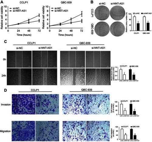 Figure 2 Knockdown of NNT-AS1 inhibited cell proliferation, migration and invasion in vitro.Notes: (A) CCK-8 assays were used to determine the viability of si-NNT-AS1-transfected cholangiocarcinoma cells. (B) Colony-forming ability was measured in CCLP1 and QBC-939 cells after transfected with si-NNT-AS1 or si-NC by clonogenic assays. (C) The migration capacities were detected in CCLP1 and QBC-939 cells transfected with si-NNT-AS1 or si-NC by wound healing assays. (D) The invasive and migration capacities were detected in CCLP1 and QBC-939 cells transfected with si-NNT-AS1 or si-NC by transwell assays. The error bars indicate the means ± SD. *p<0.05, **p<0.01.Abbreviations: NC, negative control; NNT-AS1, nicotinamide nucleotide transhydrogenase antisense RNA 1.