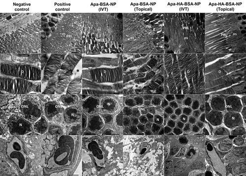 Figure 4 Electron micrographs of retinal sections from negative control show normal organized photoreceptor cell layer (PRL), the photoreceptor cells are with regular horizontal lamellar discs (D). Outer nuclear cell layer (ONL) shows minimal intercellular spaces between nuclei (N) of photoreceptor cells. Normal blood vessel (BV) with normal thickness of the basement membrane is noticed. Electron micrographs from positive control show disorganized photoreceptor cell layer (PRL) with increased interdisc spaces (*), photoreceptor cells show distorted lamellar discs (D) and vacuolated outer segments (OS). ONL shows wide spaces between photoreceptor cells’ nuclei (N). Notice BV with thickened basement membrane. Electron micrographs from Apa-BSA-NPs (IVT) group show PRL with few distorted lamellar discs and vacuolated OS and increased interdisc spaces (*), these findings are more prominent in Apa-BSA-NPs (Topical) group. Electron micrographs from Apa-HA-BSA-NPs (IVT) and Apa-HA-BSA-NPs (Topical) groups show almost normal retinal ultra-structure. All treated groups showed normal BV basement membrane thickness.