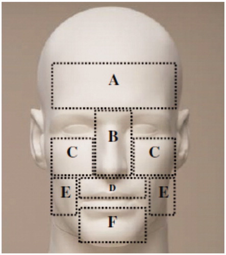 Figure 1. Six facial regions for the measurements of facial temperatures and warmth sensitivity. (A) forehead, (B) nose, (C) cheekbone, (D) upper lip, (E) cheek and (F) chin.