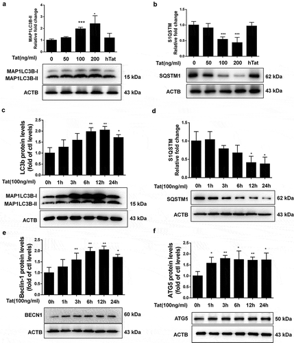 Figure 1. Tat-mediated induction of autophagy in HBMECs.