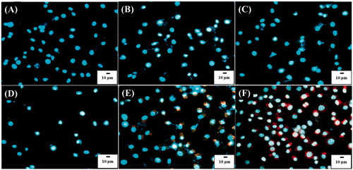 Figure 5. Overlapped images of L929 cell (1 ml, ∼106 cells mL−1) obtained after incubated with POA-Au NPs at the concentrations of (A) 0, (B) 62.5, (C) 125, (D) 250, (E) 500 and (F) 1000 µgmL−1 for 6 h, from dark field and fluorescence microscopy. The cells were stained by Hoechst 33342. The excitation wavelength was set at 330–380 nm and the exposure time was set to 20 ms. The scale bar is 10 µm.