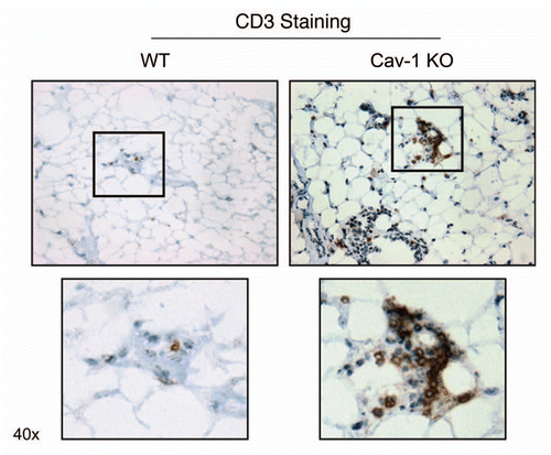 Figure 5 Cav-1 (−/−) mammary fat pads show the upregulation of CD3(+) cells. Mammary fat pads from wild-type (WT) and Cav-1 (−/−) null mice were harvested and processed for immuno-staining. Note that Cav-1 (−/−) null mammary fat pads show the upregulation of CD3(+) cells, consistent with T-cell infiltration. Boxed areas are also shown at higher magnification. Original magnification, 40x.