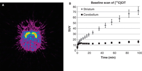 Figure 2. Target-controlled infusion to reach pseudosteady state of [11C]CITin cerebellum. As expected, there was high uptake localized to striatum, as shown in a trans-axial projection of a representative subject (A). The pseudosteady state of [11C]CITin cerebellum resulted in elevated, close to irreversible striatal uptake (B). Error bars indicate SEM (n = 5).