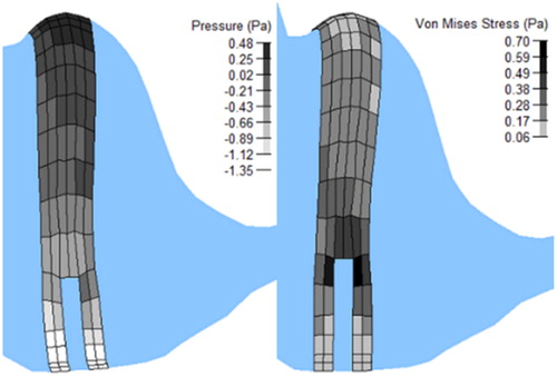 Figure 3. Pressures (left) and Von Mises stresses (right) in the cupula at the end of the deceleration (t = 100 ms).