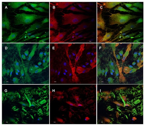 Figure 6 Dual immunocytochemical analysis for the expression of mesenchymal stem cell marker protein CD 105 (A, D and G) and cardiac marker protein actinin (B, E and H) in the coculture samples and the merged image showing the dual expression of both CD 105 and actinin (C, F and I); on the tricalcium phosphate (A–C) and gelatin nanofibers (D–F) and poly(glycerol sebacate)/gelatin core/shell fibers (G–I) at 60× magnification.Note: Nucleus stained with DAPI (4′,6-diamidino-2-phenylindole). Reprinted with permission Tissue Eng Part A. Ravichandran R, Venugopal JR, Sundarrajan S, Mukherjee S, Ramakrishna S. Poly(glycerol sebacate)/gelatin core/shell fibrous structure for regeneration of myocardial infarction. Copyright 2011 Mary Ann Liebert Inc.Citation44