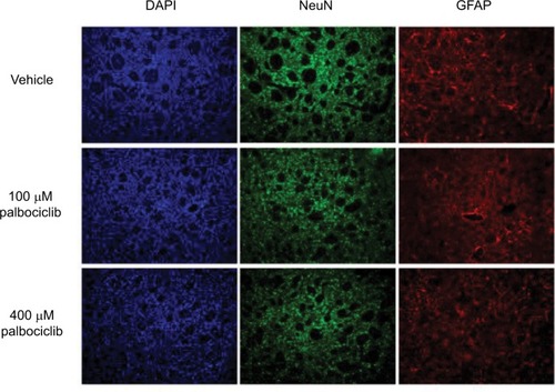 Figure 9 Direct delivery of palbociclib into rat brain did not elicit discernible toxicity.Notes: Palbociclib was infused into the striatum of rat brains at a rate of 1 µL/min (5 µL total) at either 100 or 400 µM. Tissue was harvested after 48 hours and analyzed using immunofluorescence staining. Tissue morphology appeared normal in rats dosed with palbociclib, suggesting no significant toxicity. Cell nuclei were stained with DAPI (blue); neurons were stained with NeuN antibody (green); glial cells were stained with GFAP antibody (red).Abbreviations: DAPI, 4′,6-diamidino-2-phenylindole; NeuN, neuronal nuclear protein; GFAP, glial fibrillary acidic protein.