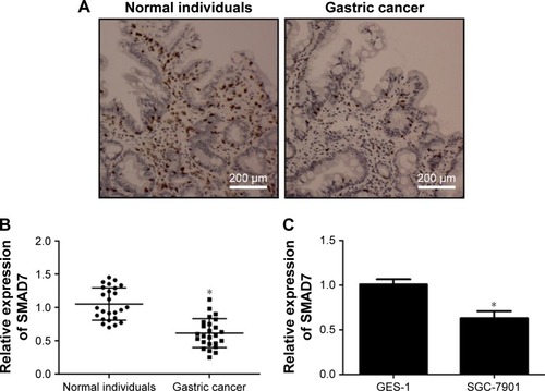 Figure 3 SMAD7 decreased in GC tissues and GC cell lines.