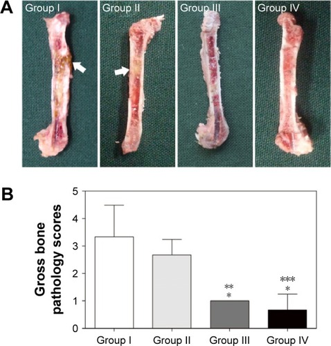 Figure 2 Gross appearance and scores of the left femur longitudinal sections at the time of sacrifice.Notes: (A) Gross appearance. The white arrows mark intramedullary pus formation. (B) Gross bone pathology scores evaluation. The mean gross bone pathological scores of groups I through IV were 3.33±1.16, 2.67±0.58, 1.00±0.00, and 0.67±0.58, respectively. *Denotes a significant difference compared with group I (P<0.01, n=3). **Denotes a significant difference compared with group II (P<0.05, n=3). ***Denotes a significant difference compared with group II (P<0.01, n=3). Groups I, II, III, and IV indicate Ti + S. aureus, NT + S. aureus, NT-G + S. aureus, and Ti + PBS, respectively. Ti, titanium without modification.Abbreviations: NT, nanotubes; NT-G, gentamicin-loaded nanotubes; PBS, phosphate-buffered saline; S. aureus, Staphylococcus aureus.
