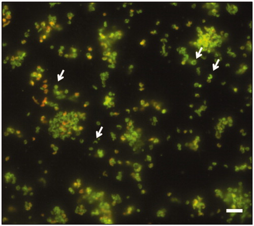 Figure 2. Representative image of fluorescence microscopy of H. pylori NCTC11637 biofilm after 10 days of incubation. The white arrows indicate the coccoid, donut and U-shape morphologies. The biofilm was stained with Live/Dead kit. Scale bar =5 μm.