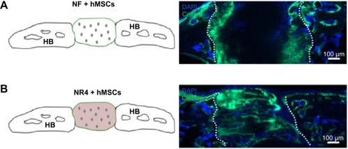 Figure 9 In vivo analysis of BMP-7 nanoreservoirs’ and hMSCs’ effect on bone tissue mineralization.Notes: In vivo bone induction onto NF PCL scaffold with hMSCs (A) or onto NR4 PCL scaffold with hMSCs (B) 30 days after calvaria implantation in nude mice. Cell nucleus is in blue, stained with DAPI; bone information is shown in green, stained with calcein. For all images, scale bars =100 μm.Abbreviations: HB, host bone; hMSCs, human mesenchymal stem cells; NF, not functionalized; NR4, functionalized with (chitosan/BMP-7)4 nanocontainers; PCL, poly(ε-caprolactone).