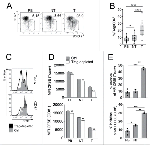 Figure 1. Suppressive Tregs accumulate at T site in CRC patients. (A–B) Representative CD127/FOXP3 staining (A) and percentages of Tregs (B) in gated CD4+ T cells in PB, NT and T samples of CRC patients (n = 31). *p < 0 .05, ****p < 0 .001, by Wilcoxon matched-pairs test, two-tailed. In all figures, Tregs and Tconvs have been identified as FOXP3+ CD127low or FOXP3−, respectively, within the CD14− CD16− CD56− CD19− viability dye− CD4+ gate. (C–E) CFSE profile overlay (C), mean fluorescence intensity (MFI) of CFSE (D), and percentage of inhibition of CFSE dilution (E) in gated Tconvs (CD4+FOXP3−) or CD8+ T cells from Treg-depleted or total (Ctrl) mononuclear cells, obtained from a representative CRC patient. The experiment was repeated thrice with cells of individual patients giving similar results. *p < 0 .05, **p < 0 .01, ***p < 0 .005, by Student t test, unpaired.