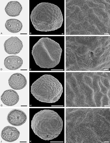 Figure 20. LM (A, D, G, J) and SEM (B, C, E, F, H, I, K, L) micrographs of dispersed fossil Ulmaceae pollen. A–F. Ulmus sp. 1, same grain with five pori, distal side of grain (B, C), and proximal side of grain (E), close-up (F) showing porus. G–L. Ulmus sp. 2, same grain, distal side of grain (H, I), and proximal side of grain (K, L). Scale bars – 10 µm (A, B, D, E, G, H, J, K), 1 µm (C, F, I, L).