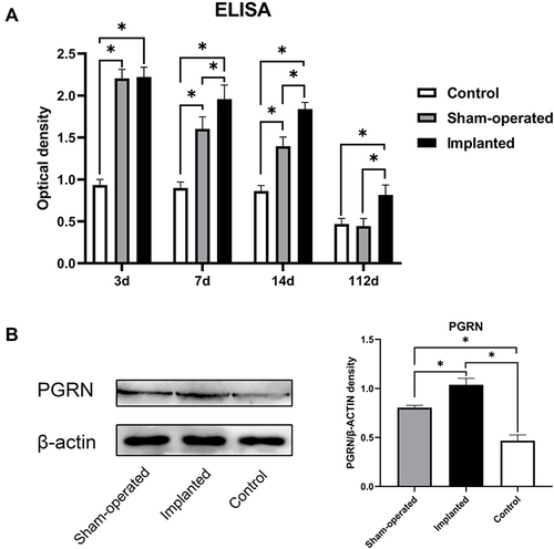 Figure 1 Surgical trauma and implant can increase plasma and local PGRN levels in SD rats, and the two have a synergistic effect. (A) The content of PGRN in the plasma of rats in different groups on days 3, 7, 14 and 112 were detected by ELISA analysis. (B) The local PGRN content in SD rats in different groups on day 14 were detected by Western blot analysis. Data are shown as the mean ± SEM (n = 4) (*p < 0.05 vs control).