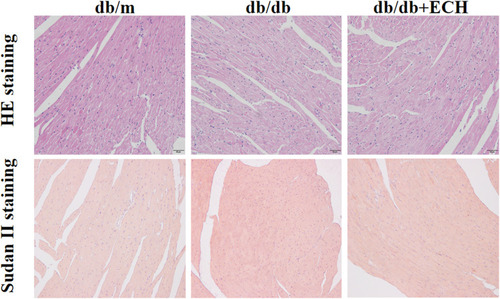 Figure 4 Effects of ECH on morphologic changes in the hearts of db/db mice (200×).