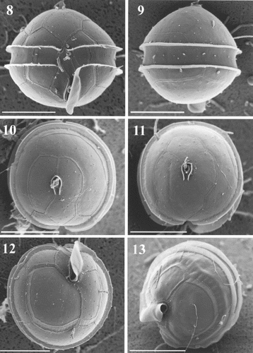 Figs 8 – 13. Oblea rotunda observed under scanning electron microscopy (SEM). Scale bars represent 10 μm. Fig. 8. Cell in ventral view showing the general plate arrangement. Fig. 9. Dorsal view. Figs 10, 11. Apical view of two cells with 3 (Fig. 10) and 4 (Fig. 11) apical plates showing epitheca tabulation. Note that girdle lists are totally smooth. Figs 12, 13. Antapical views showing the prominent left sulcal list coiled.