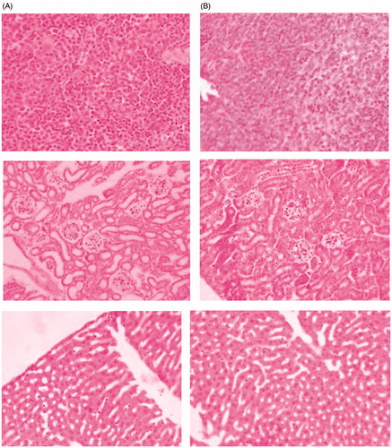 Figure 9. Histopathological studies of liver, spleen, and kidney. (A) Free ACM and (B) ACM-SLNs.
