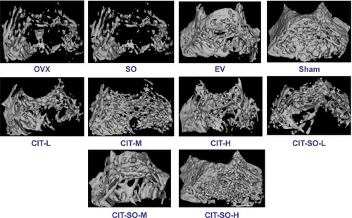 Figure 2 Representative micro-computed tomography images of trabecular bone microarchitecture in the distal femurs.Notes: The OVX rats presented notable reductions in trabecular number and trabecular area compared with the sham rats. CIT, CIT-SO, and EV partially prevented OVX-induced trabecular bone loss and significantly improved trabecular bone mass and microarchitecture. CIT-SO significantly improved trabecular bone microarchitecture compared with CIT.Abbreviations: OVX, ovariectomized; SO, suet oil; EV, estradiol valerate; CIT, circinal–icaritin; H, high dosage; M, medium dosage; L, low dosage.