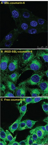 Figure 5 The confocal microscopy images of B16-F10 cells incubated with (A) SSL-coumarin-6, (B) iRGD-SSL-coumarin-6 or (C) free coumarin-6, for 2 hours at 37°C. Fluorescence of coumarin-6 exhibits green; fluorescence of Hoechst 33258 exhibits blue.Abbreviations: iRGD, tumor-homing peptide; SSL, sterically-stabilized liposome.