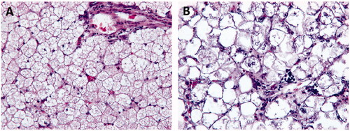 Figure 2. Effects of overfeeding between LL-Xupu geese and SL-Xupu geese. (A) Histology observation of SL-Xupu geese liver (200 ×). (B) Histology observation of LL-Xupu geese (200 ×).