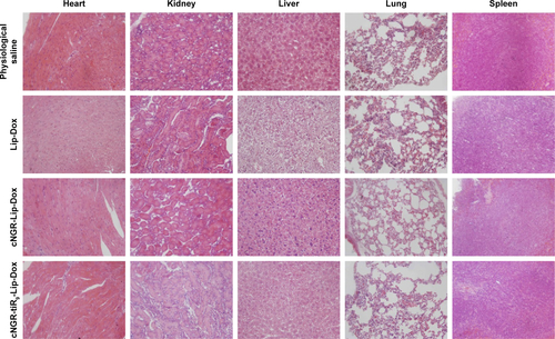 Figure S5 H&E-stained tissue sections from mice after treatment, examined by light microscopy. Magnification 200×.Abbreviations: cNGR, cyclic asparagine–glycine–arginine; Dox, doxorubicin; Lip, liposomes; tiR9, tandem-insert nona-arginine.