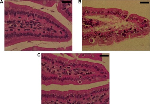 Figure 3 Effect of ZNPs on Eimeria papillata-induced jejunum injury on day 5. (A) Noninfected jejunum with normal architecture of the absorptive epithelium and lamina propria. (B) Infected jejunum with some pathological changes in lamina propria and absorptive epithelia. Developmental stages appearing in the absorptive epithelia. (C) Infected treated mouse exhibiting fewer parasites.Notes: Sections are stained with hematoxylin and eosin. Bar =25 μm.Abbreviation: ZNP, zinc oxide nanoparticle.