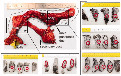 Figure 4. Results of the in vivo experiments. Macroscopic images of one of the treated pancreas and cross sections at the level of the head (A) and body (B). Red circles indicate the position of the main duct. Lumen was not completely closed in all cases and ductal dilation was observed, particularly in the body (units in cm). Gray dashed line indicates the main duct position in pancreas.