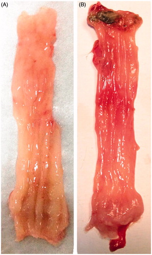 Figure 2. Macroscopic appearances of normal rat rectum (A) and dinitrochlorobenzene and acetic acid-induced colitis rat rectum (B).